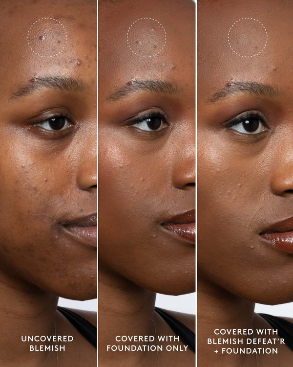 Fenty Skin Blemish Defeat’r BHA Spot-Targeting Gel (R510)