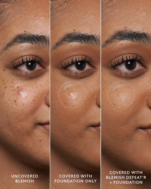 Fenty Skin Blemish Defeat’r BHA Spot-Targeting Gel (R510)