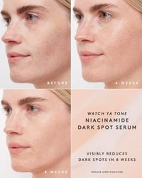Fenty Skin Watch Ya Tone Dark Spot Serum 30ml